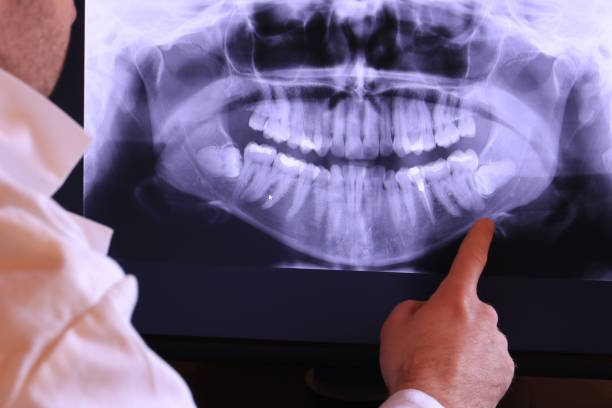Best Broken or Cracked Tooth Emergency Dentist in Sheffield, OH