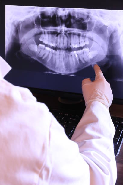 Best Emergency Dentist for Lost Fillings or Crowns in Sheffield, OH